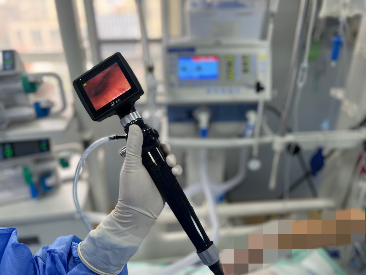 "镜"显神通丨我院icu成功开展床旁纤维支气管镜技术