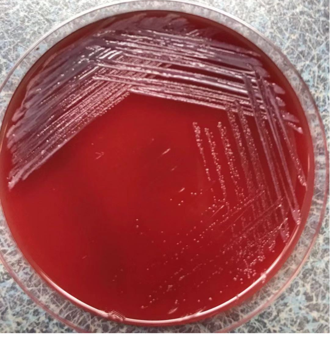 图二:二氧化碳环境孵育48h,第三代培养24h后,出现β溶血现象,再次上机