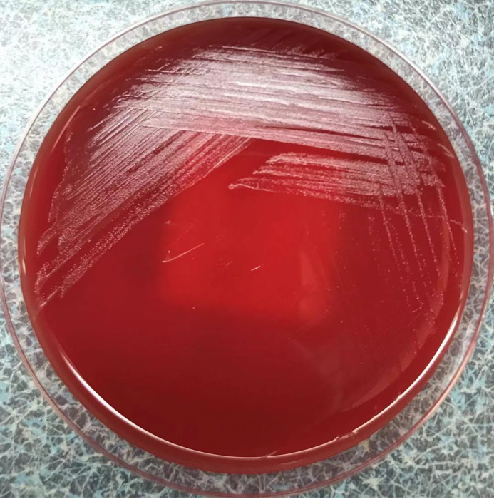 图二:二氧化碳环境孵育48h,第三代培养24h后,出现β溶血现象,再次上机